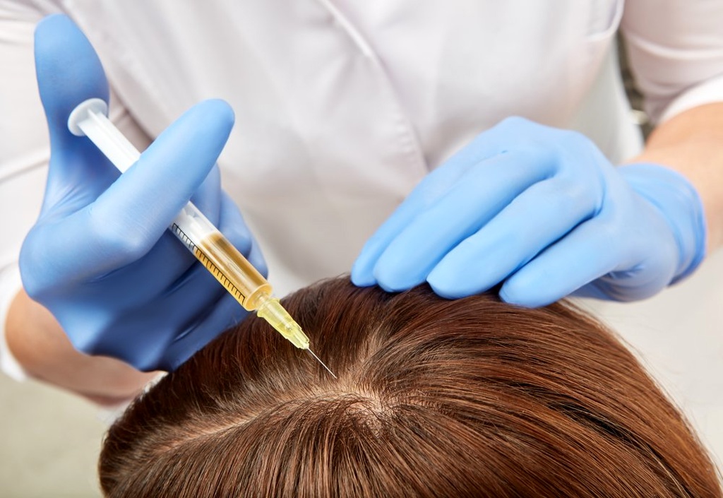 wellnesshair-restoration-prp-what-are-the-side-effects-of-a-prp-injection