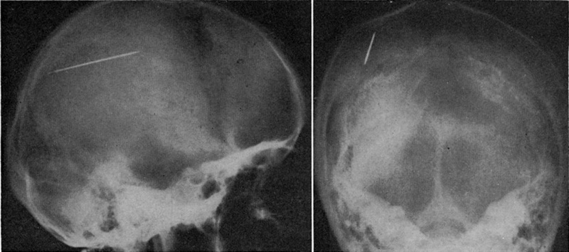 full-jns_1961_18_4_0554.fig001