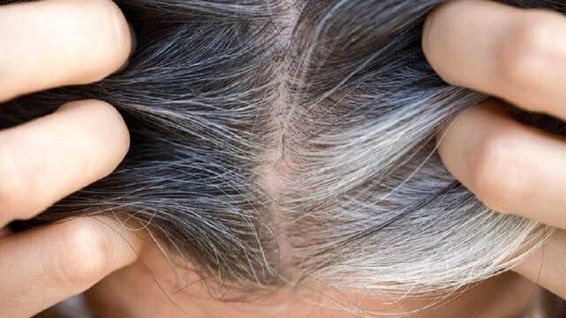 ۶ توصیه کاربردی برای جلوگیری از سفید شدن مو