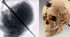 چرا اسپانیایی‌های باستان جمجمه‌ها را «میخکوب» می‌کردند؟